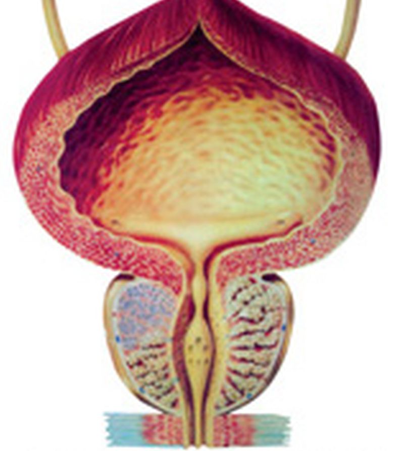 Zakaj prostata povzroča lahko hude težave
