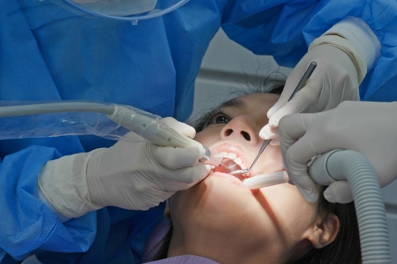 Zobne luske so prava rešitev če ste nezadovoljni z videzom vaših zob